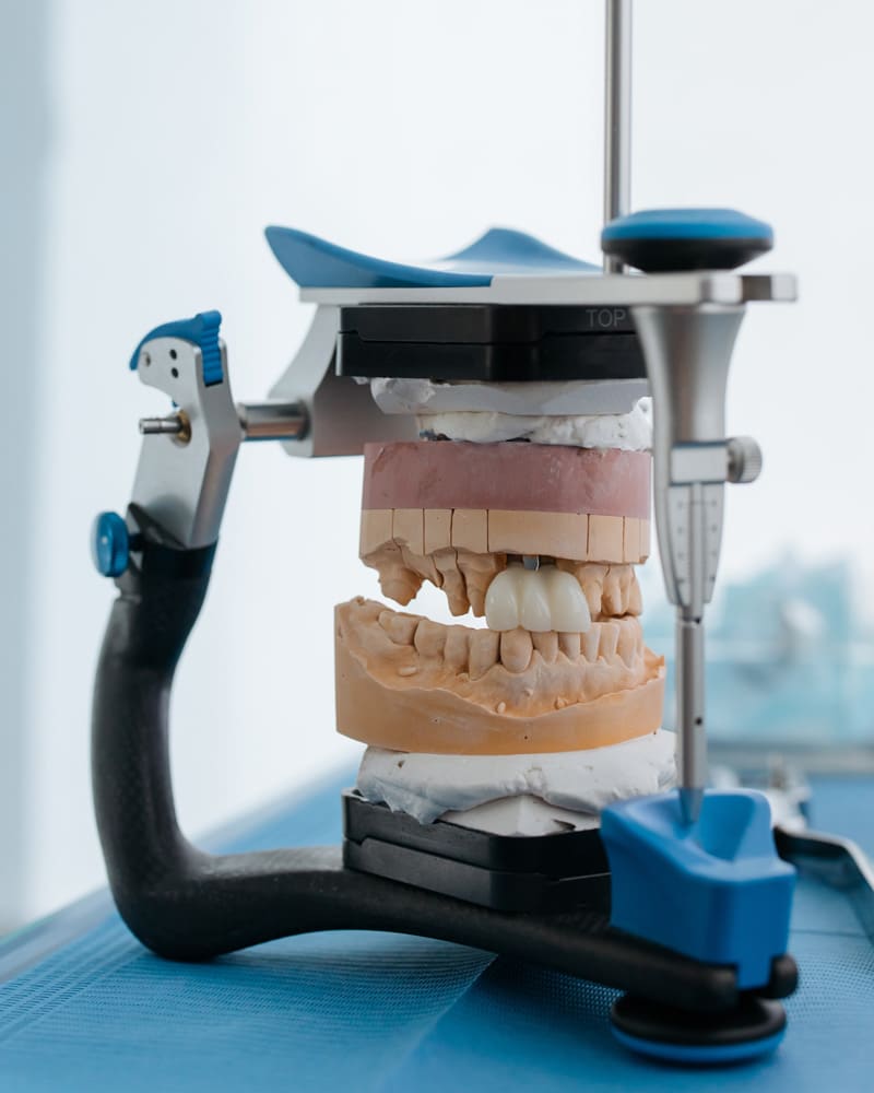 Prótesis dental en Tomares